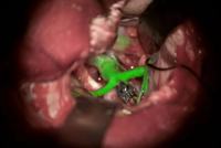 Leica徕卡             GLOW800              神经外科手术显微镜