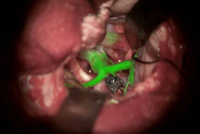 Leica徕卡             GLOW800              神经外科手术显微镜