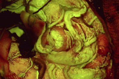 Leica徕卡           FL560                神经外科手术显微镜