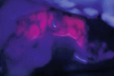 Leica徕卡          FL400                 神经外科手术显微镜