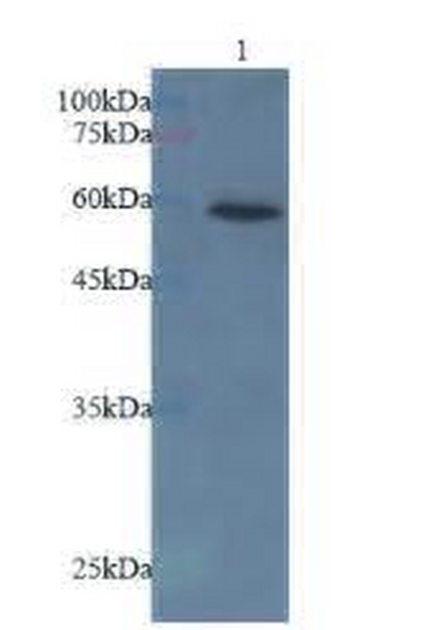 Anti AKT2 polyclonal antibody