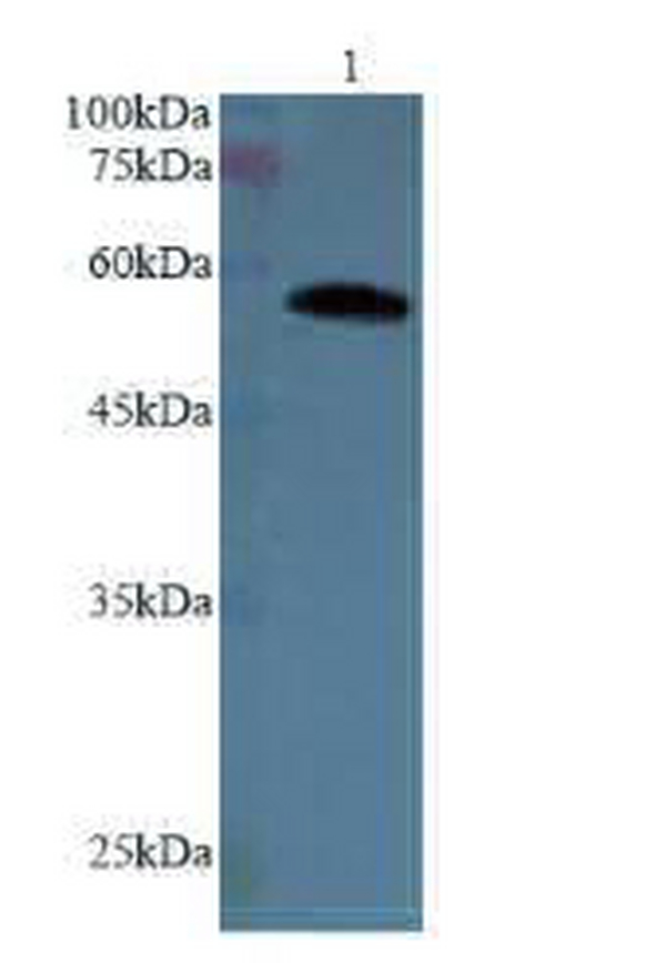 Anti AKT3 polyclonal antibody