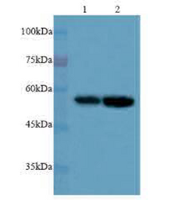 Anti Vimentin polyclonal antibody
