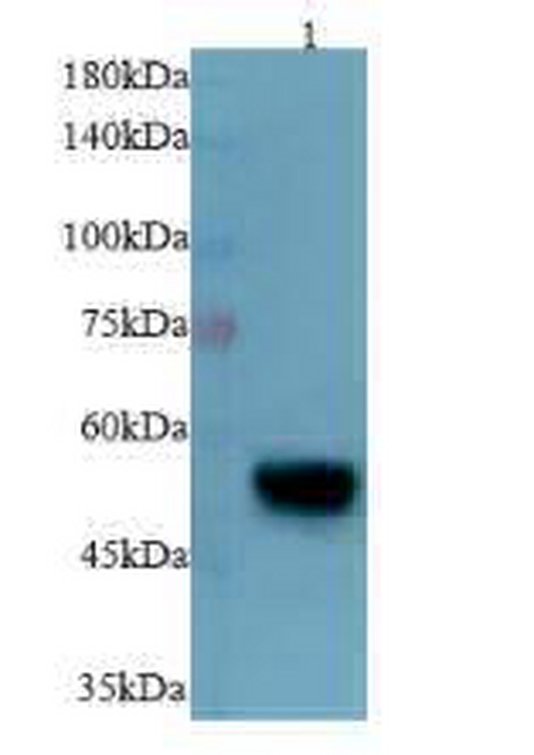 Anti Desmin polyclonal antibody