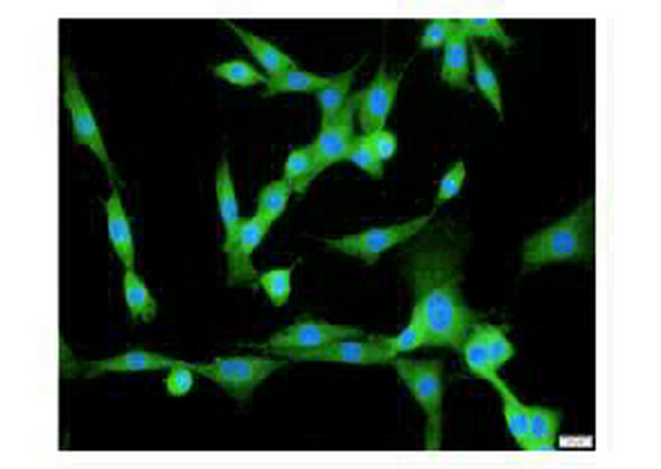 Anti CCND1 polyclonal antibody
