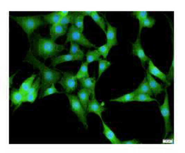 Anti CCND2 polyclonal antibody