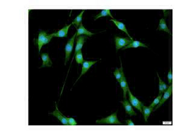 Anti CREB polyclonal antibody