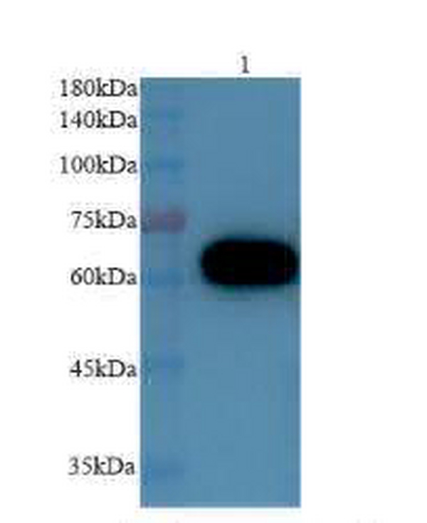 Anti MCSF polyclonal antibody