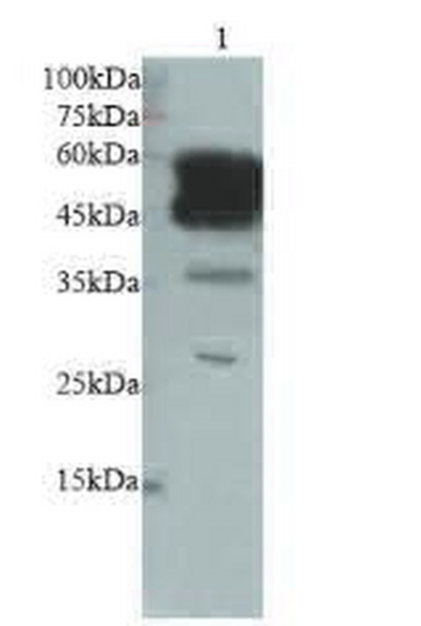 Anti CD147 polyclonal antibody