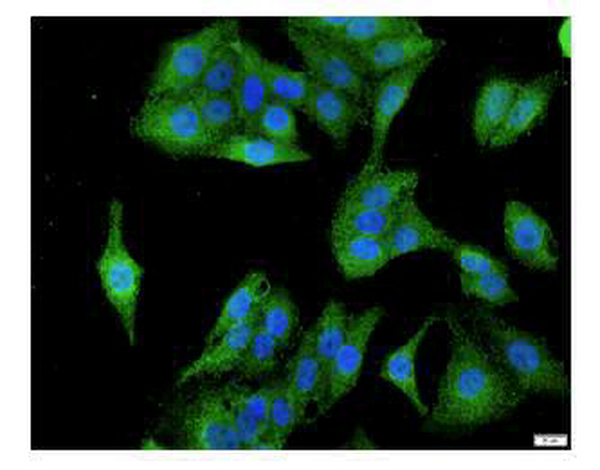 Anti Caspase 1 polyclonal antibody