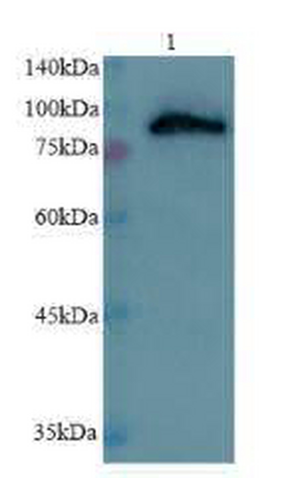 Anti CPT1A polyclonal antibody