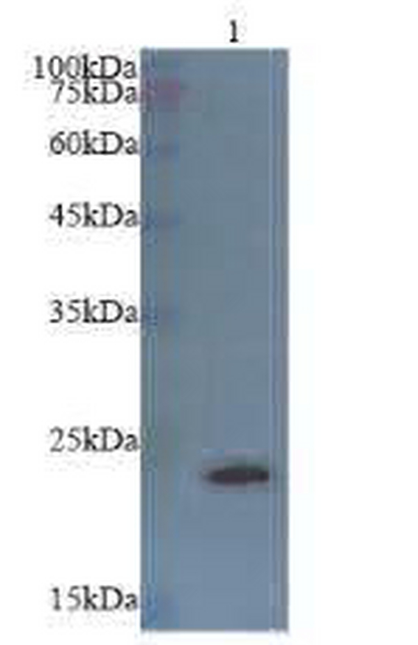 Anti BTC polyclonal antibody