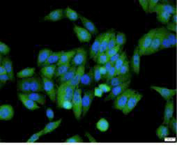 Anti APOA4 polyclonal antibody