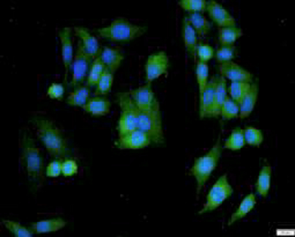 Anti ANG polyclonal antibody