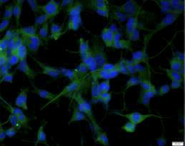 Anti AIF1/IBA1 polyclonal antibody