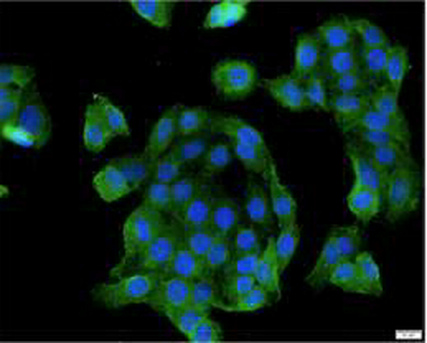 Anti ALDH1A1 polyclonal antibody