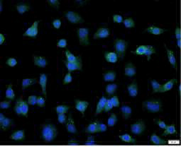 Anti ADAM10 polyclonal antibody