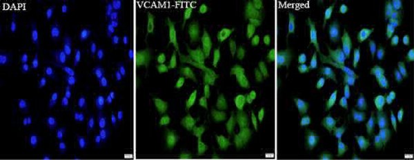 Anti VCAM1 polyclonal antibody