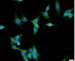 Anti Bcl2 polyclonal antibody