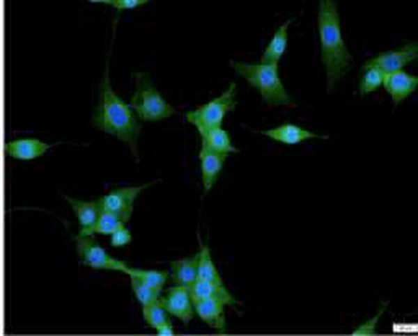 Anti BCL2L1 polyclonal antibody