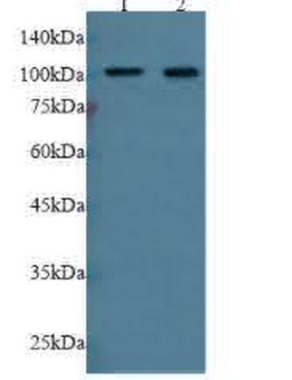 Anti ERN1 polyclonal antibody