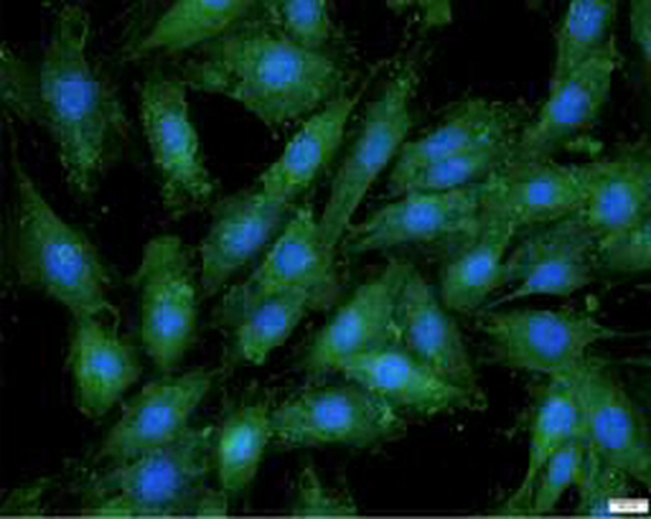 Anti EGR1 polyclonal antibody