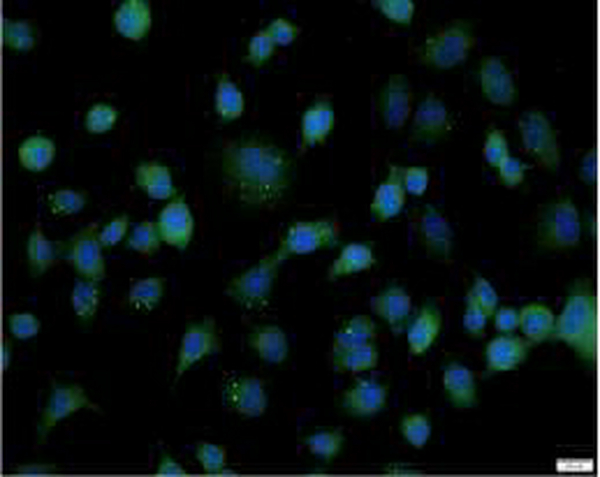 Anti DKK2 polyclonal antibody