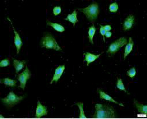 Anti DKK1 polyclonal antibody