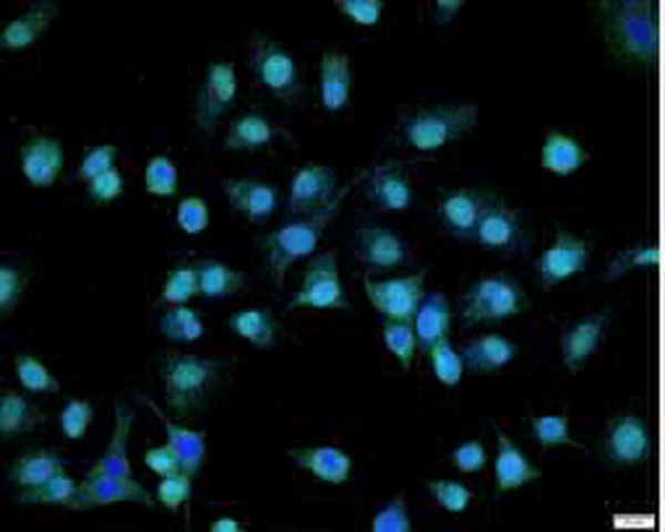 Anti NSE polyclonal antibody