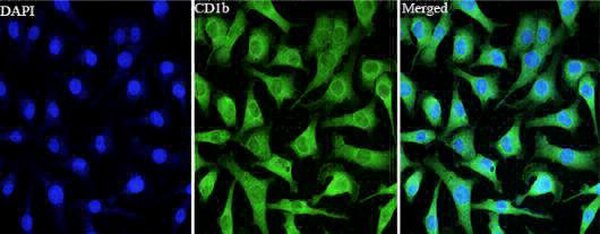 Anti CD1b polyclonal antibody