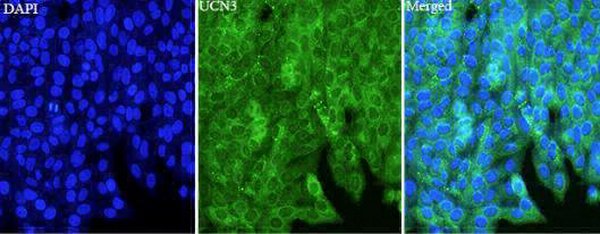 Anti UCN3 polyclonal antibody