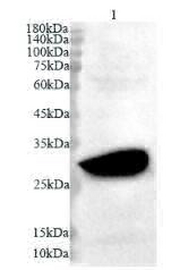 Anti OTUB2 polyclonal antibody