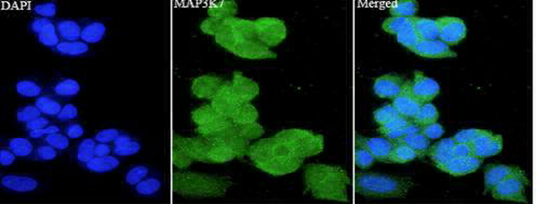 Anti MAP3K7 polyclonal antibody