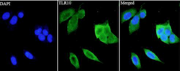 Anti TLR10 polyclonal antibody