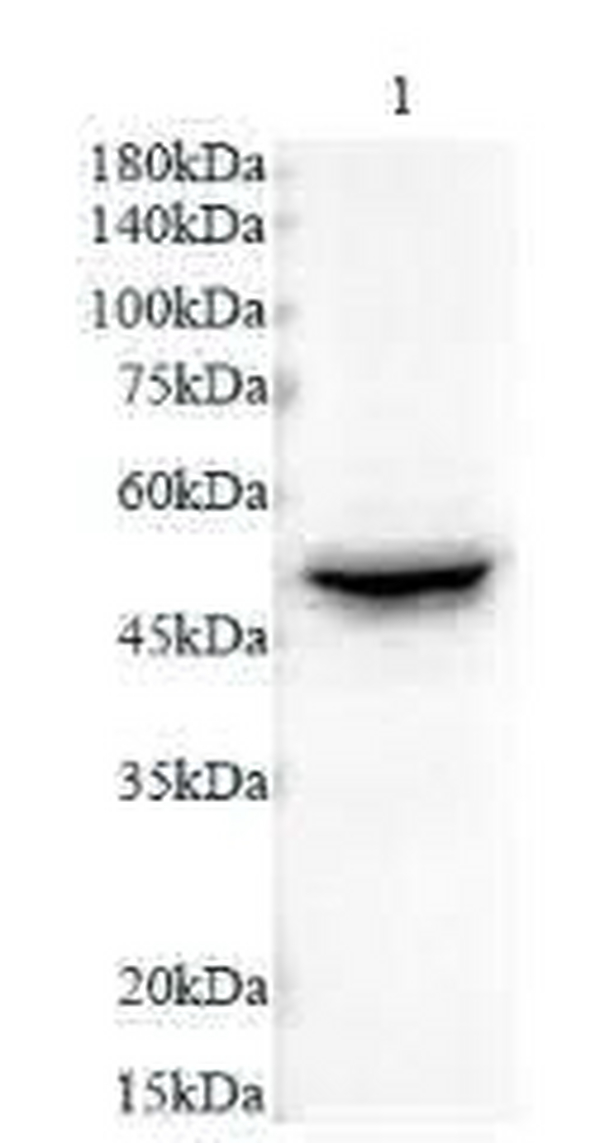 Anti CK-8 polyclonal antibody