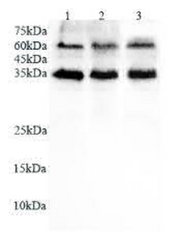 Anti CD16b polyclonal antibody