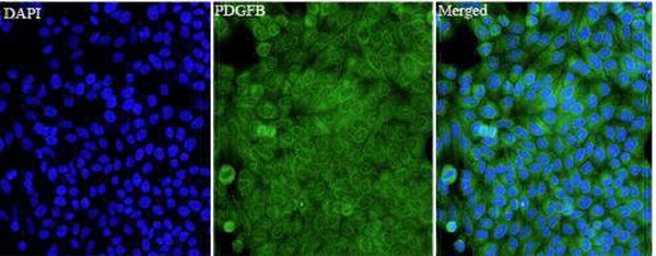 Anti PDGFB polyclonal antibody