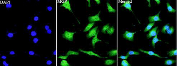 Anti MGP polyclonal antibody