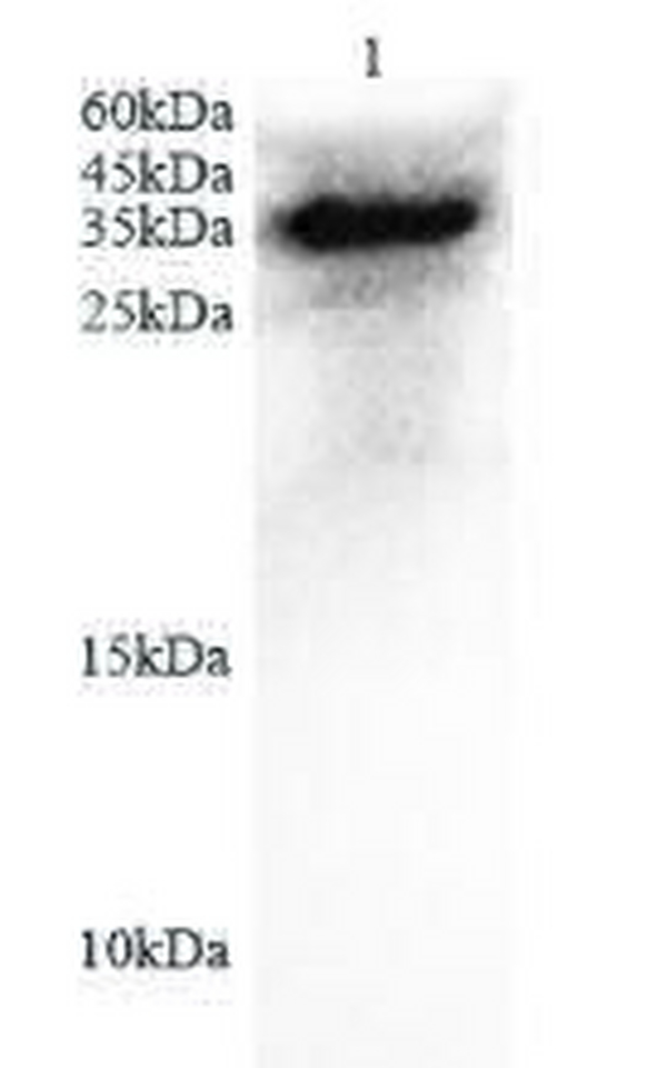 Anti IL6 polyclonal antibody