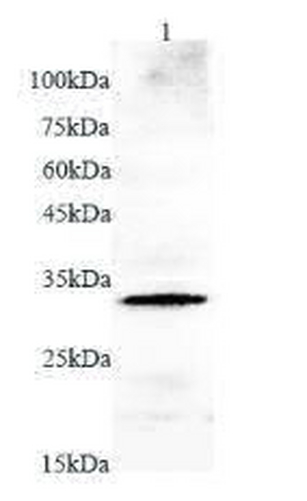 Anti MMP7 polyclonal antibody