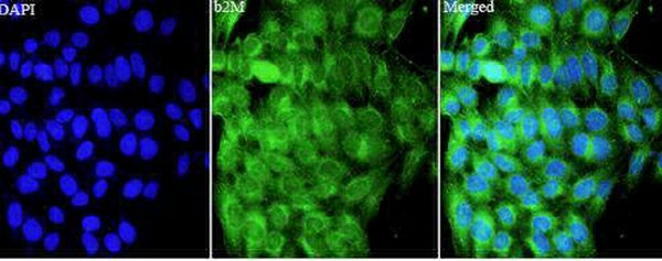 Anti B2M polyclonal antibody