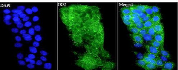 Anti IRS1 polyclonal antibody