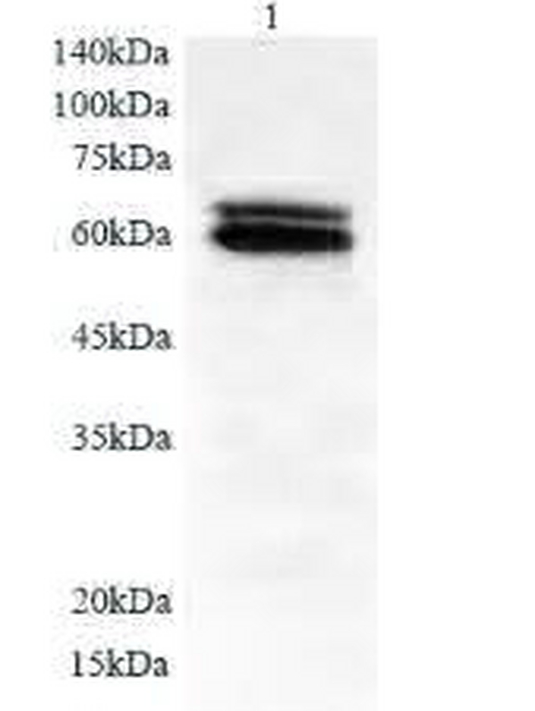 Anti SLC39A6 polyclonal antibody