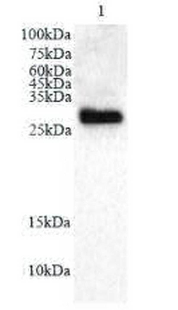 Anti NGF polyclonal antibody