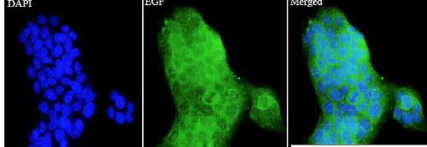 Anti EGF polyclonal antibody