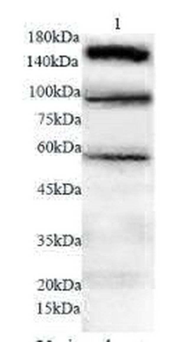 Anti ISR polyclonal antibody