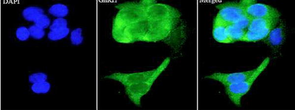 Anti GnRH1 polyclonal antibody