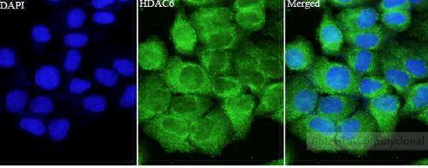Anti HDAC6 polyclonal antibody