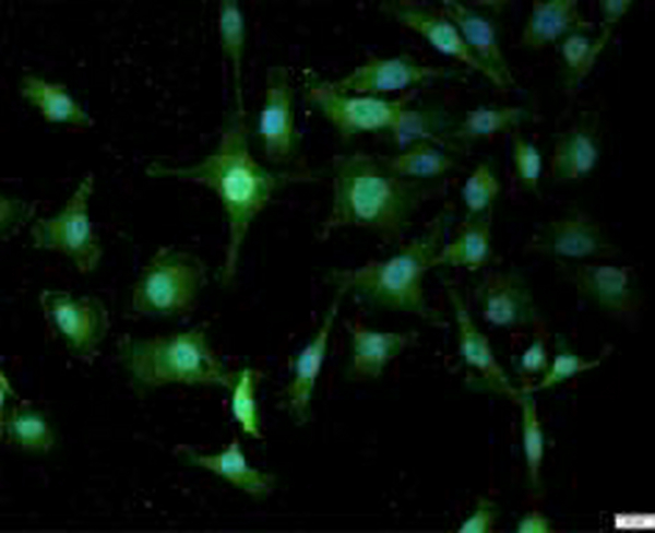 Anti NOX4 polyclonal antibody