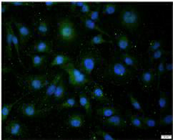 Anti PAH polyclonal antibody